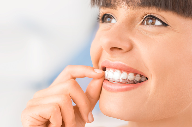 Invisalign in Crowley